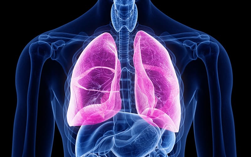 acute lung diseases