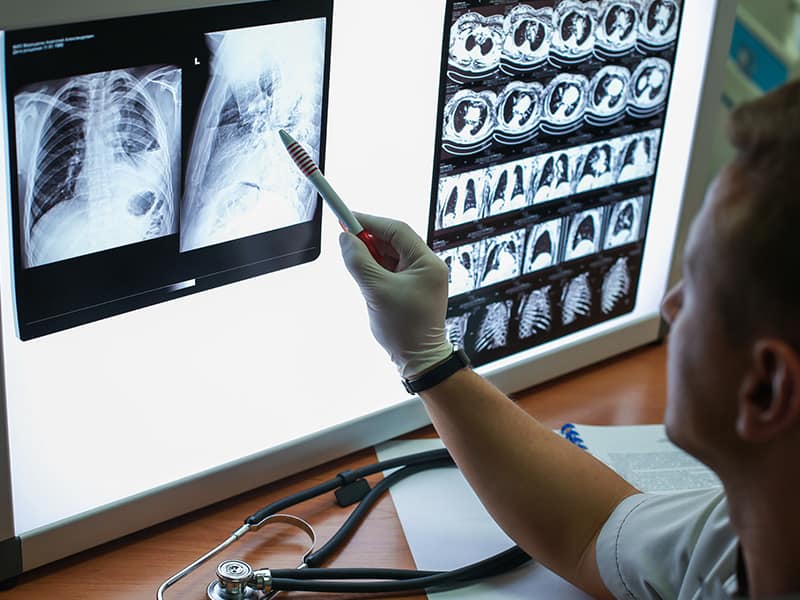 lung CT scan - lung disease - Echelon Health