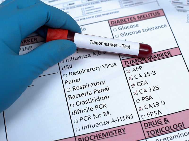 Echelon Health - can a blood test detect cancer - Tumour Marker Test