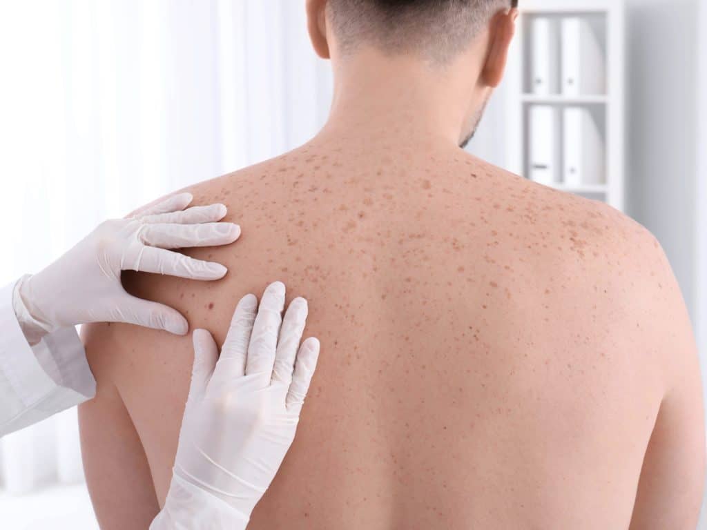 Skin Cancer Screening | Skin Cancer Risk | Echelon Health