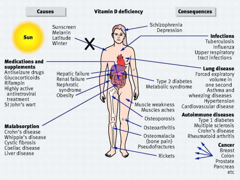 vitamin D deficiency impacts on health - Echelon Health