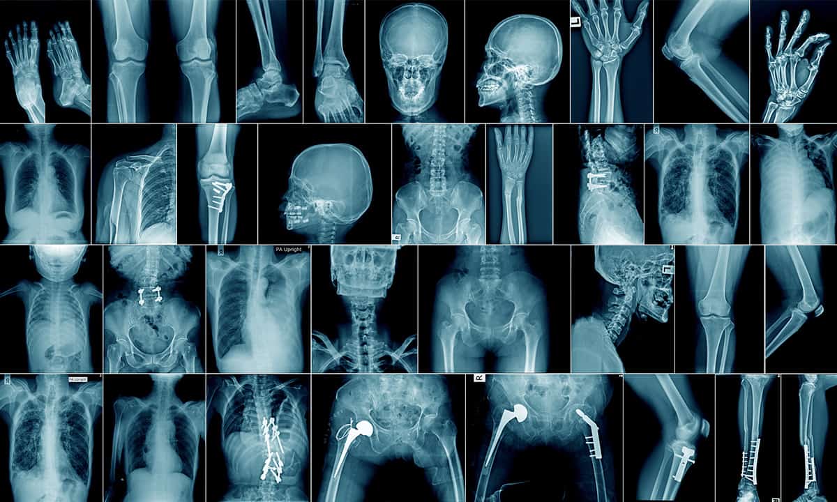 Radiology -Why Is It Important In Healthcare